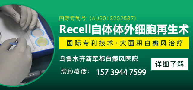 在线咨询